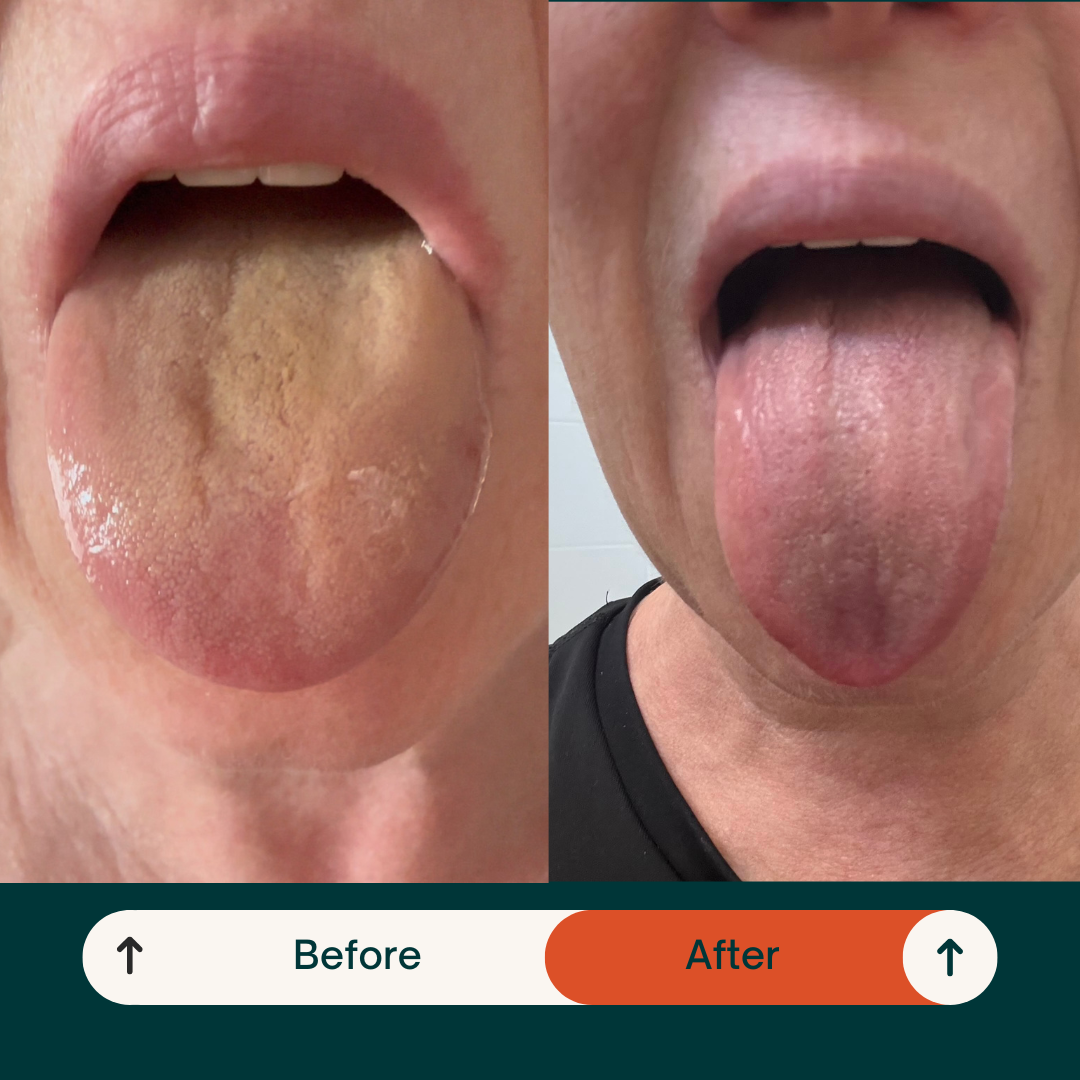 Detoxing Copper Tongue Scraper